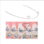 TMA Double Loop Wires (Mashroom Teller)